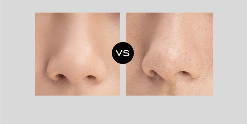 Vacuum blackhead instrument electric suction pore