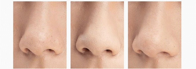 Vacuum blackhead instrument electric suction pore